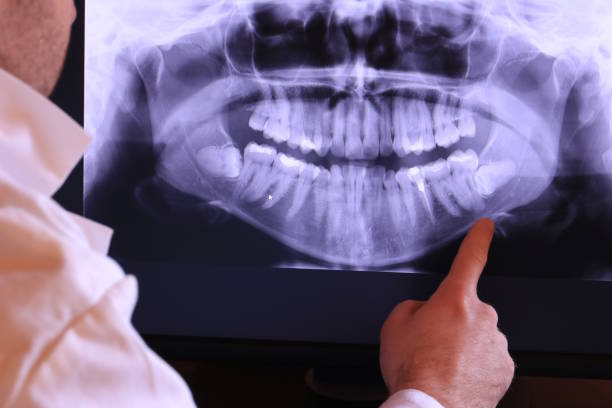 Best Broken Tooth Emergency  in South Whittier, CA